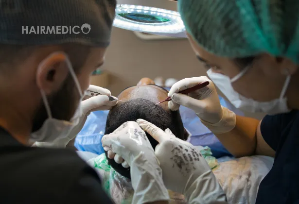 Hair Transplant Trends and Innovations 2025